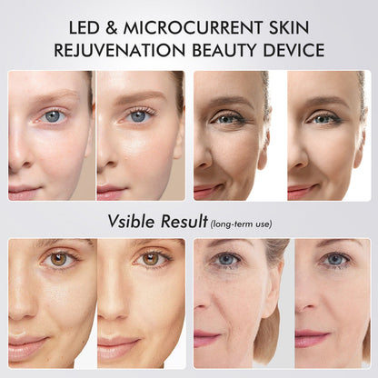 Lucid Aura Age Booster Pro - Microcurrent Facial Device